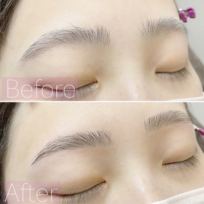 Example of eyebrow hair removal (threading) treatment results