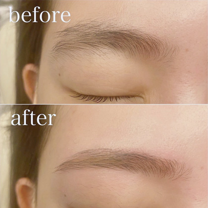 Example of eyebrow hair removal (threading) treatment results