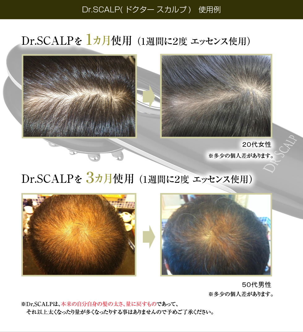 Dr.SCALP ドクタースカルプ