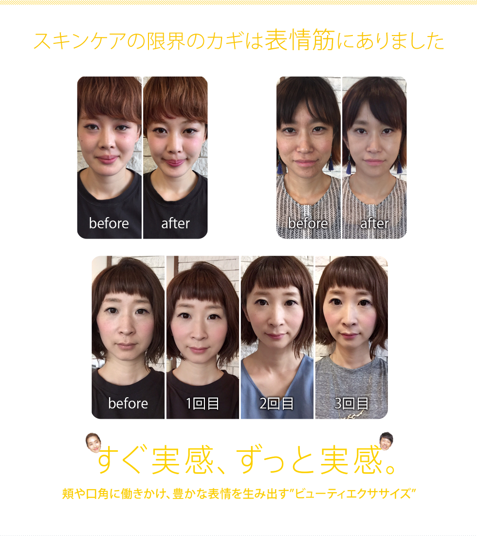 瞬間上向き顔 SMILE DESIGNスマイルデザイン