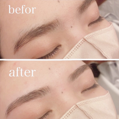 Example of eyebrow hair removal (threading) treatment results