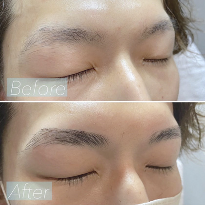 Example of eyebrow hair removal (threading) treatment results